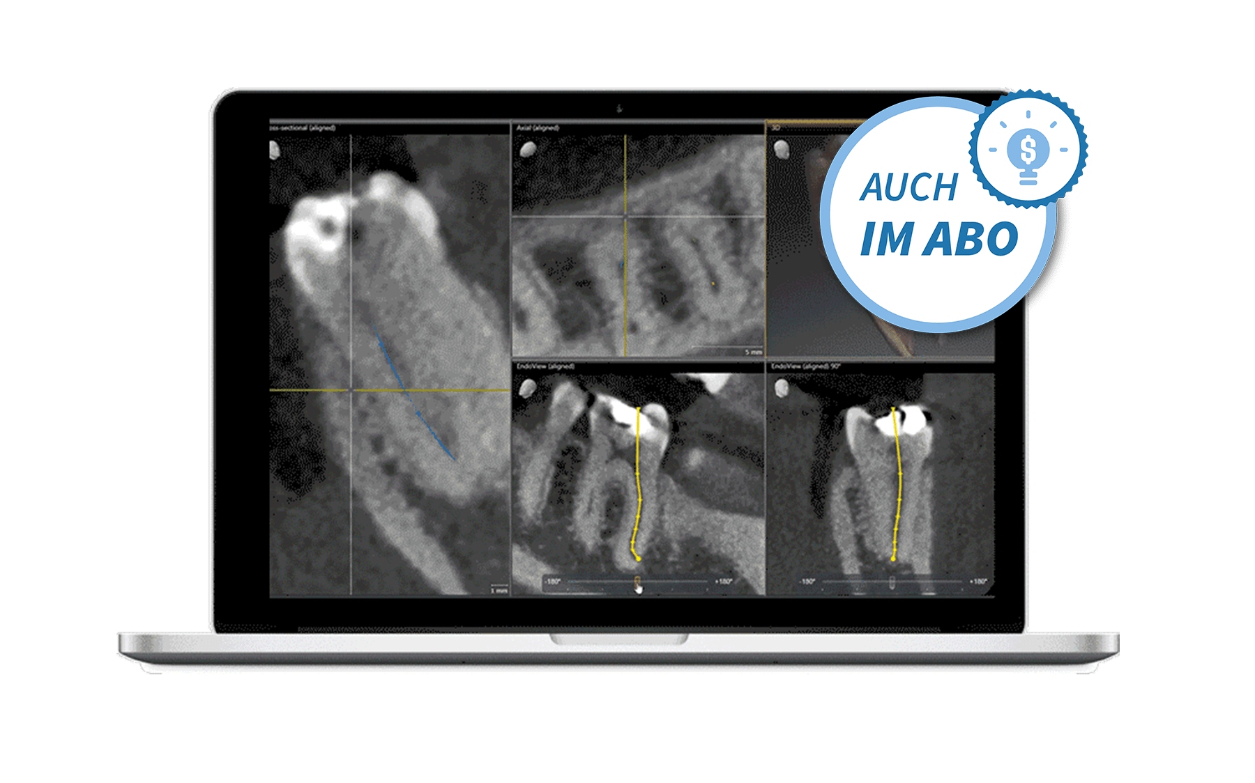 products_endodontie_img_badge_de2-min