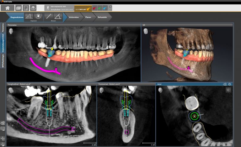 what-you-need_implant-version-2